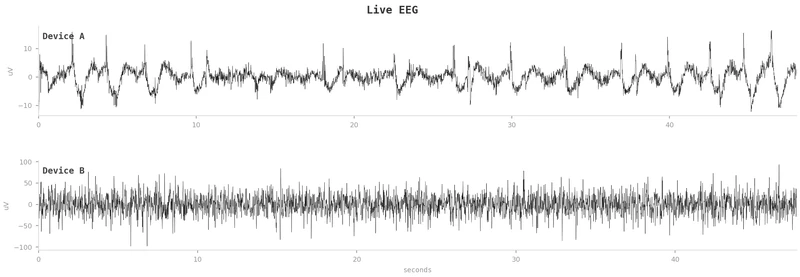 EEG smart mask analysis